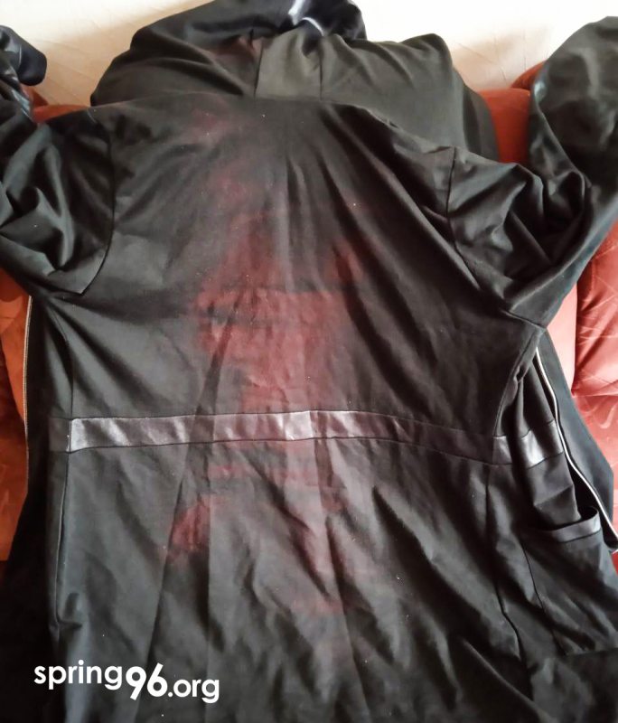 Куртка Елены Дедюли, которую обрисовали силовики на поле 1 сентября