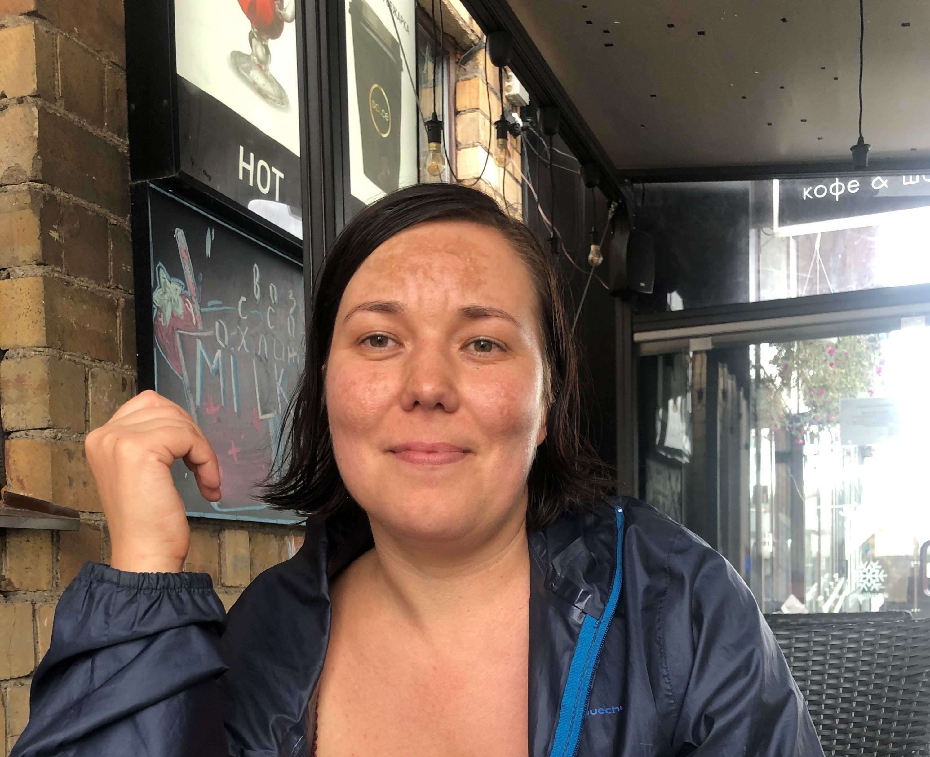 Katya (Ekaterina) Novikova several hours after her release from detention. Minsk, August 12, 2020. © Human Rights Watch