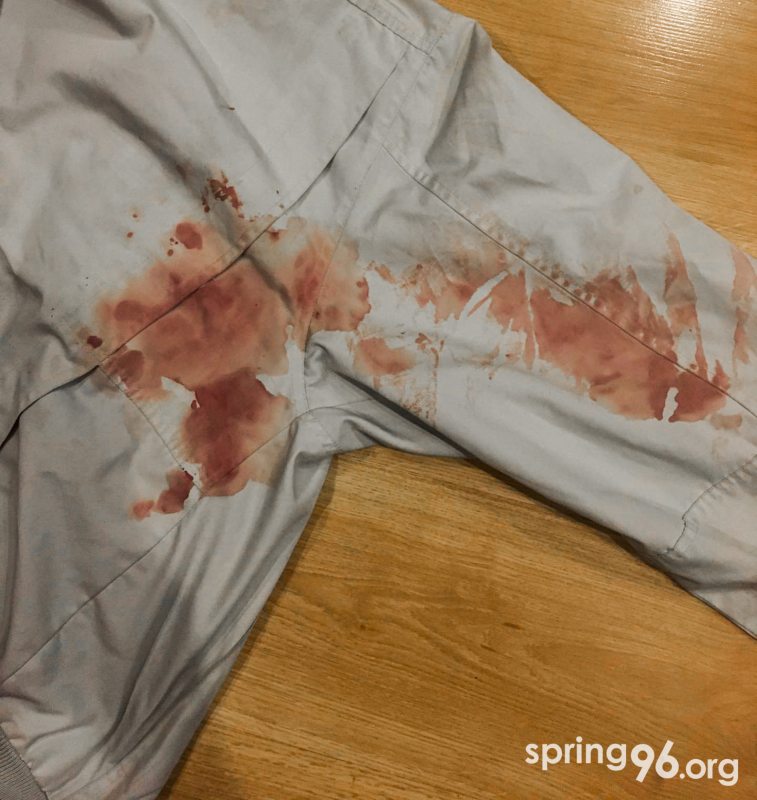 Кровь однокурсников на куртке студентки после того, как они на ней полежали в милицейском бусе