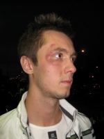 LGBT activist beaten by police